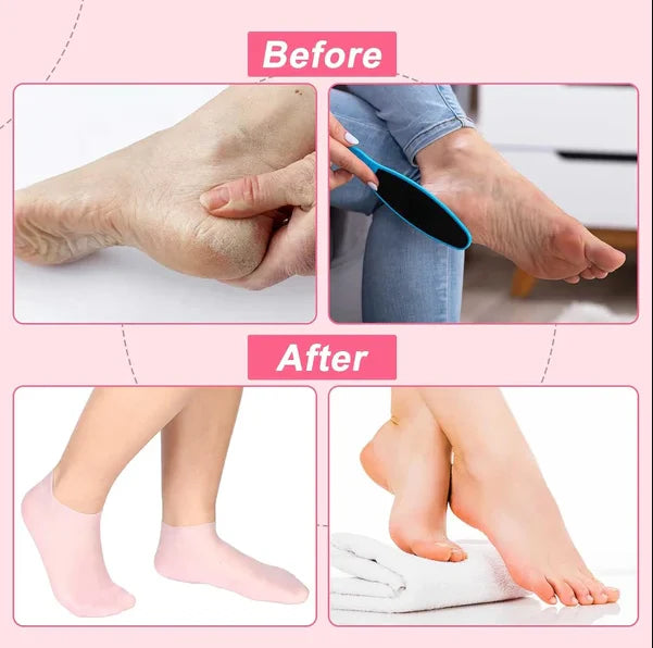 Silicone Gel Socks Pair